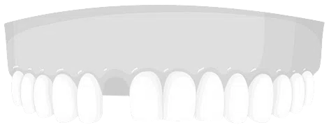 Get High Quality Dental Implants At An Affordable Price